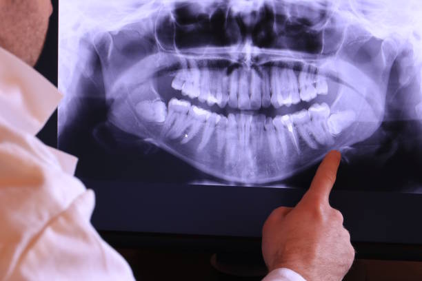 Best Mobile Emergency Dentist in Aumsville, OR